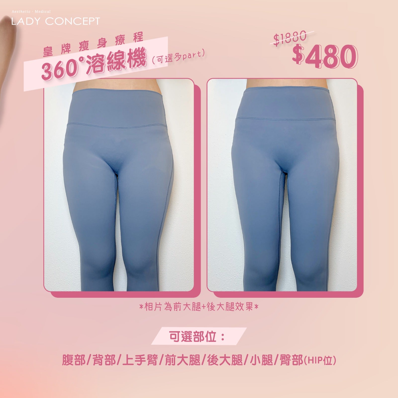 5.22-23 360°溶線機限時優惠 – 水瓶座美容健康纖體中心 Aquarius Beauty